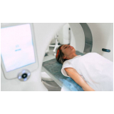 tomografia abdominal marcar Jaçanã