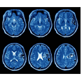 tomografia computadorizada do crânio marcar data Jardim Londrina