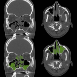 tomografia computadorizada dos seios da face marcar data Jardim América