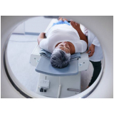 tomografia da pelve marcar Bela Cintra