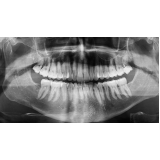 tomografia odontológica Centro