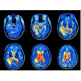 tomografias computadorizadas do crânio Jundiaí
