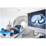 valor de exame ressonância magnética cabeça Socorro