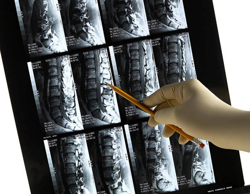 Tomografia Computadorizada da Coluna Lombar  Fazenda Morumbi - Tomografia Computadorizada de Crânio