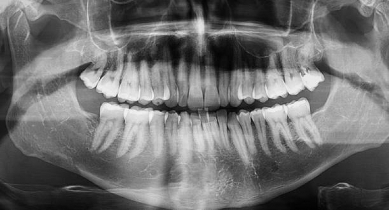 Tomografia Odontológica Consolação - Tomografia do Tórax